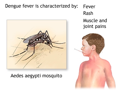 A health worker fumigating a neighborhood in Colón to reduce mosquito populations amid rising dengue cases